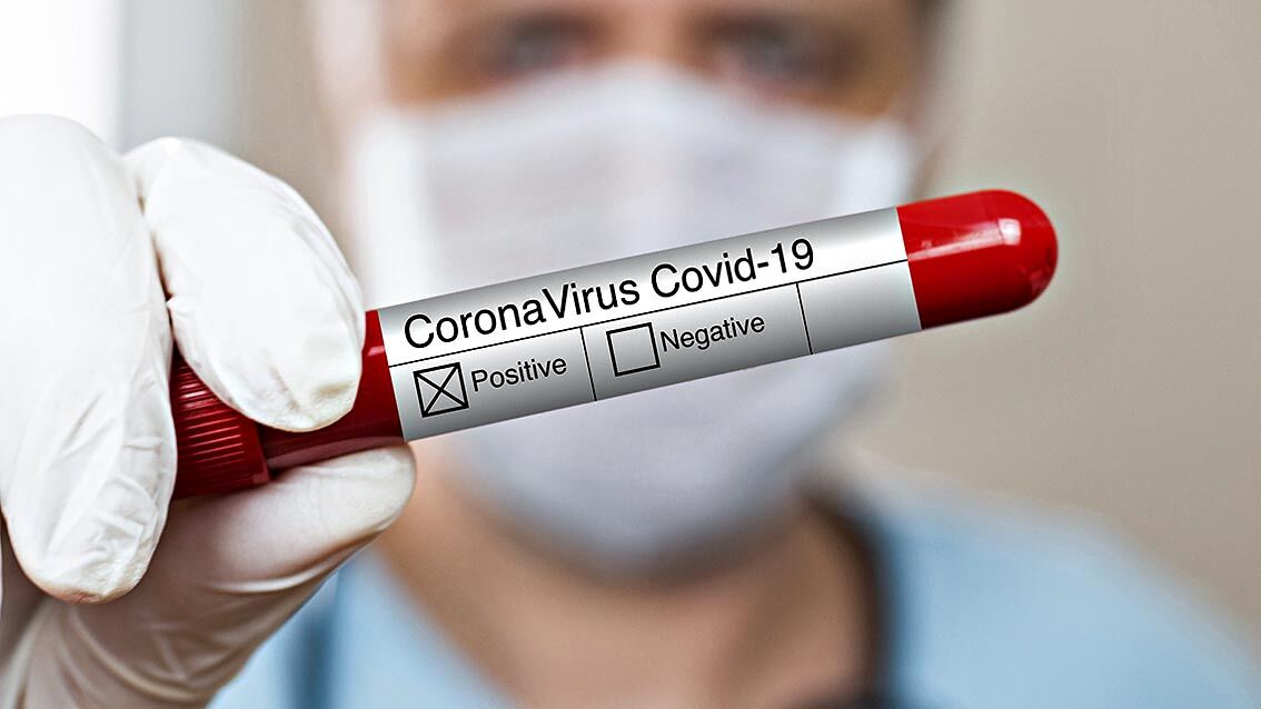 A blood test may show if you have antibodies to COVID-19.
